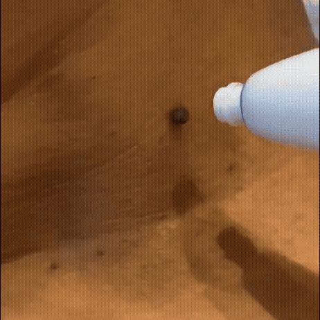 Alcura™ Complete Set – Geen huidflapjes meer