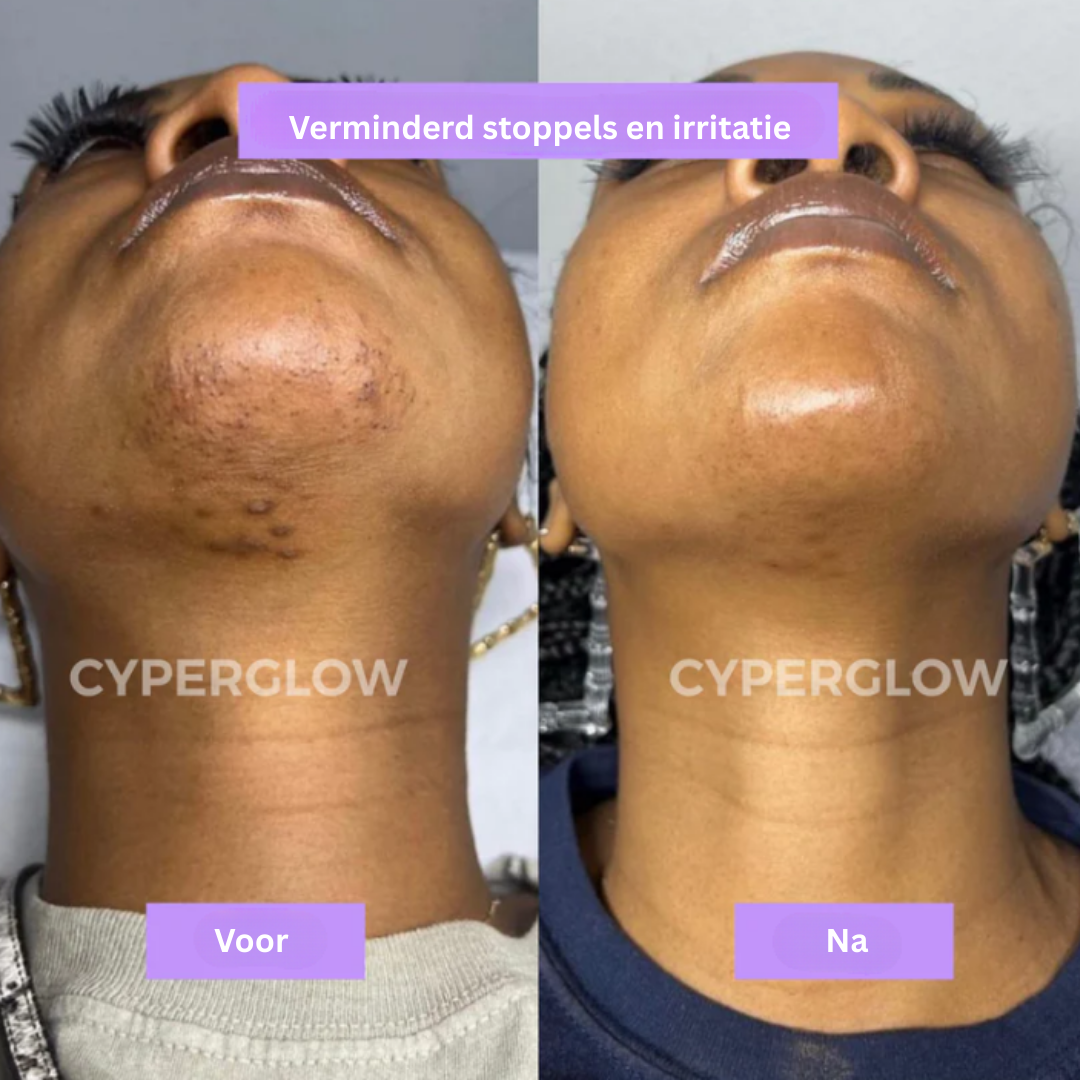 CyperGlow™ - Natuurlijk Haarverminderend Serum