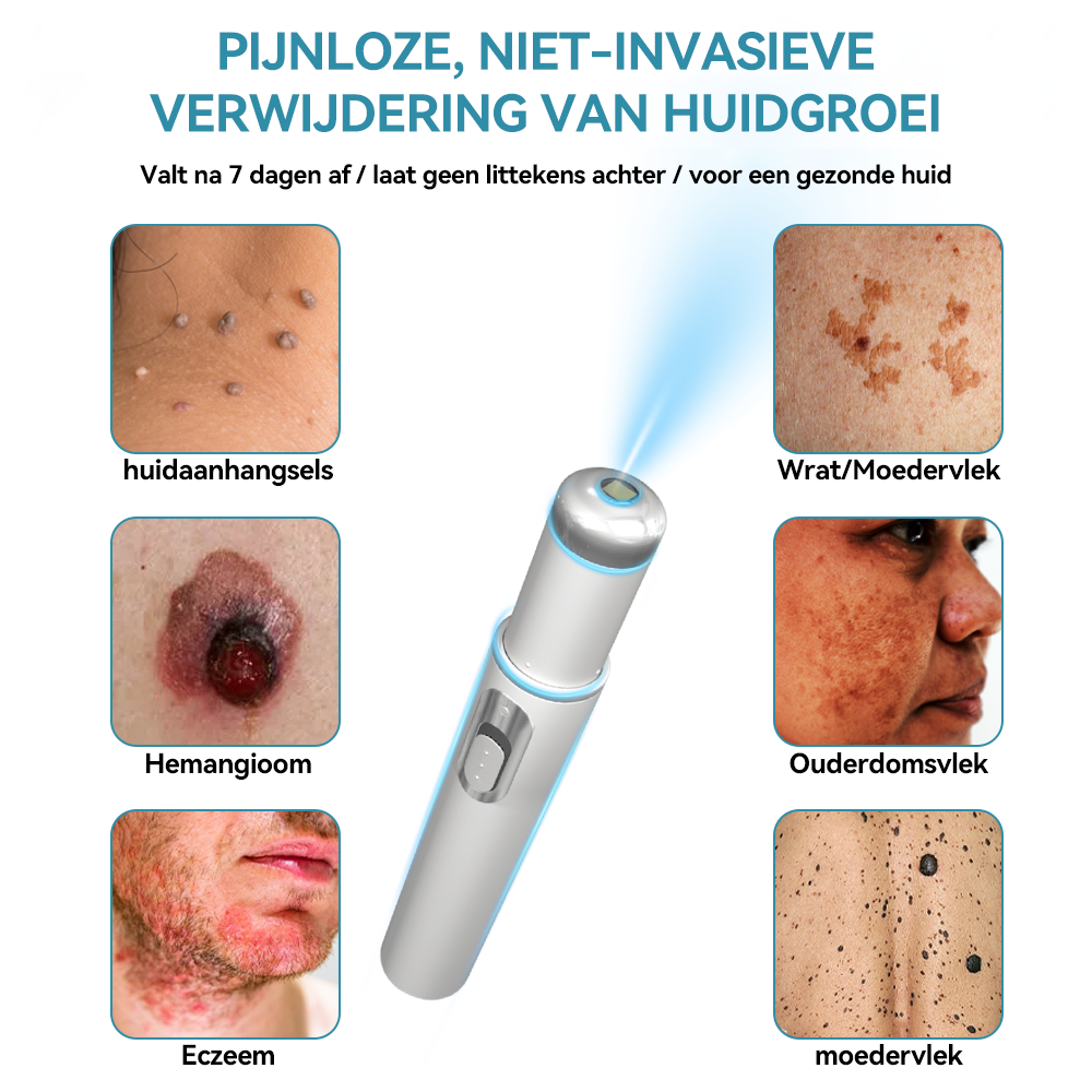 Bikenda® Laserpen – Verwijder Moedervlekken & Wratten Thuis