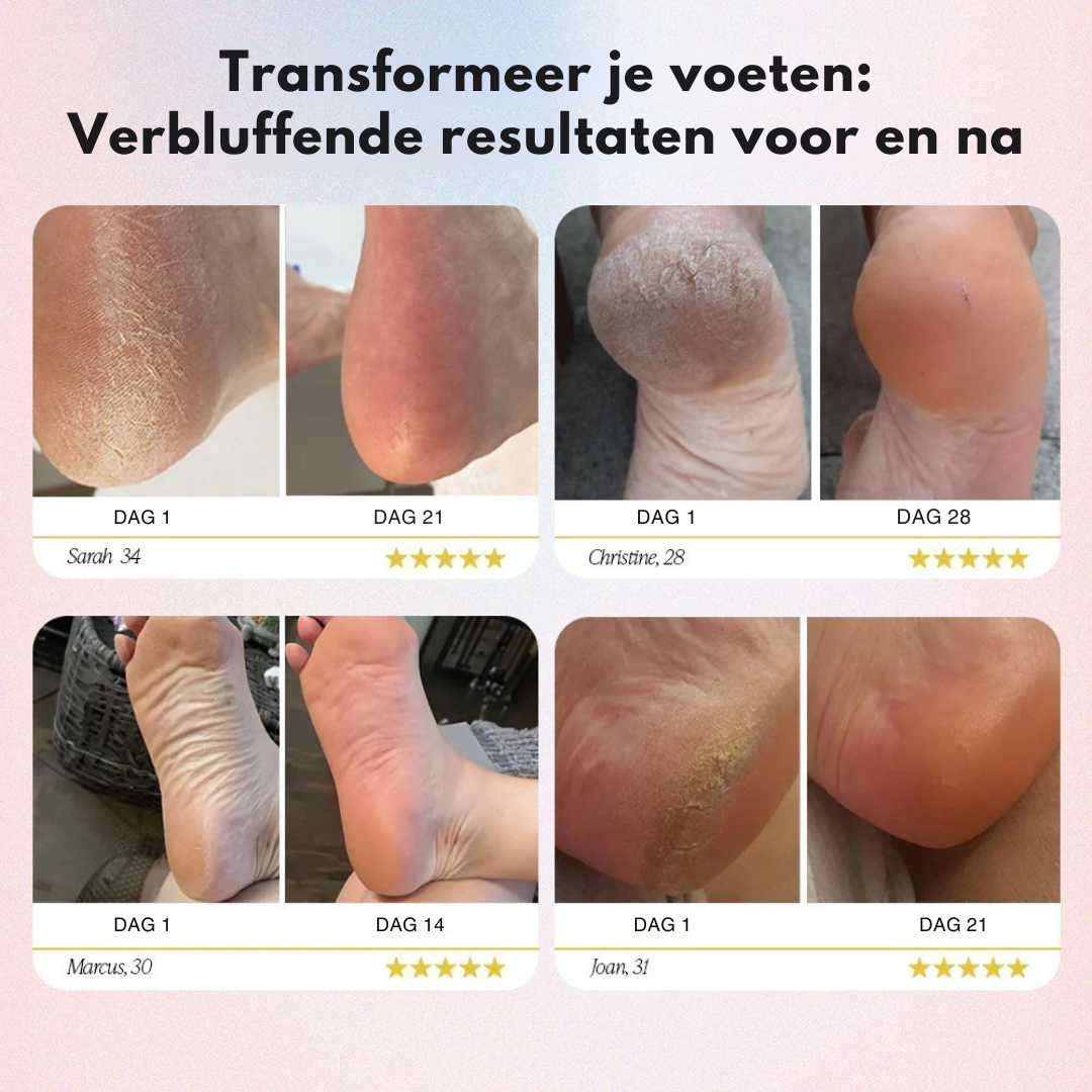 PediCare™ - Zachte, gezonde voeten in minuten