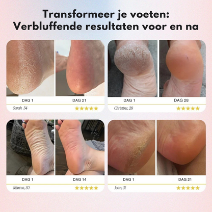 PediCare™ - Zachte, gezonde voeten in minuten