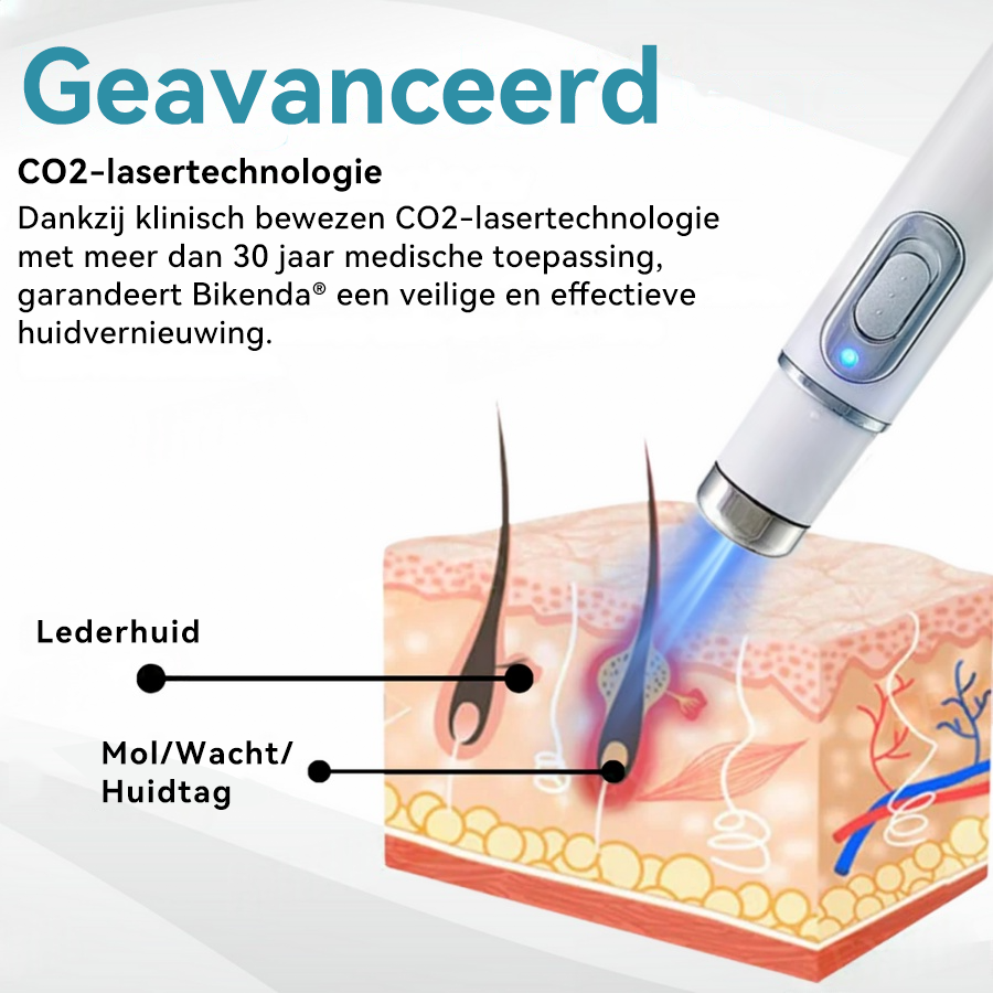 Bikenda® Laserpen – Verwijder Moedervlekken & Wratten Thuis