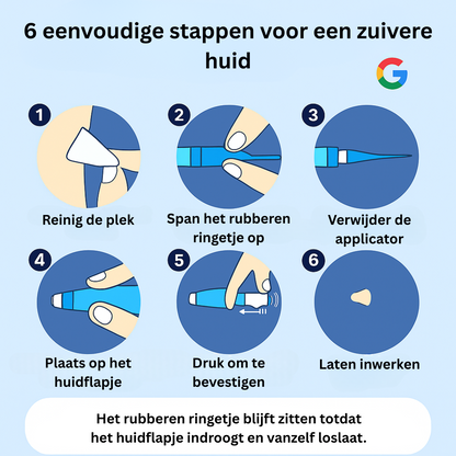 Alcura™ Complete Set – Geen huidflapjes meer