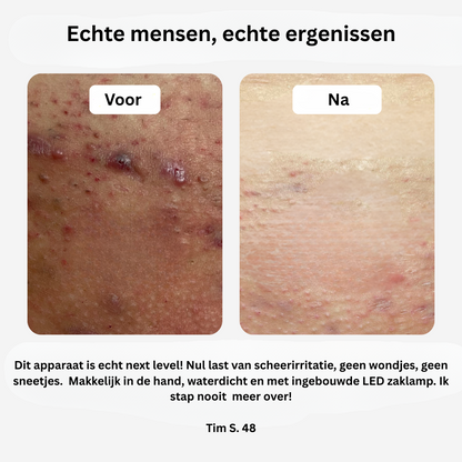 SmoothTrim™ – Voor lichaams- en intieme verzorging