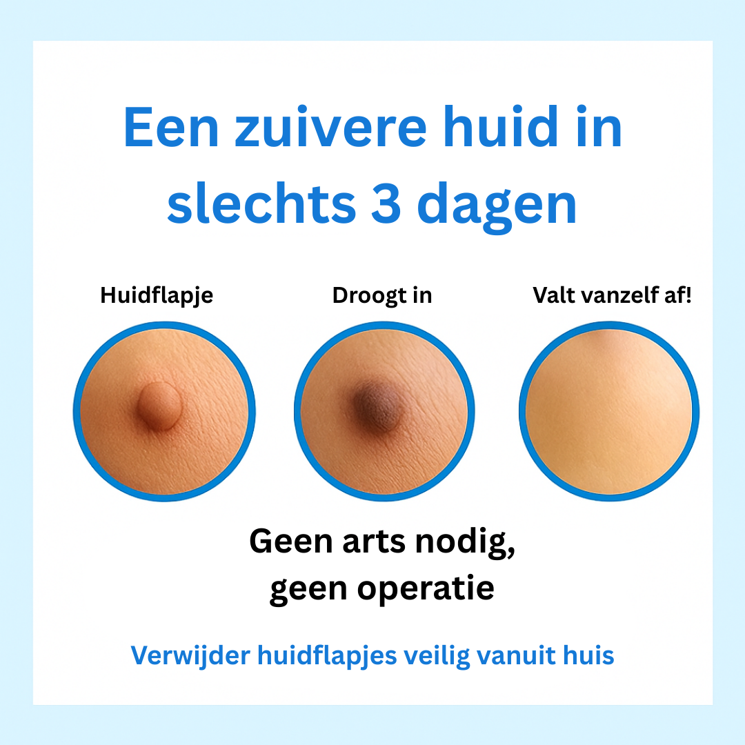 Alcura™ Complete Set – Geen huidflapjes meer