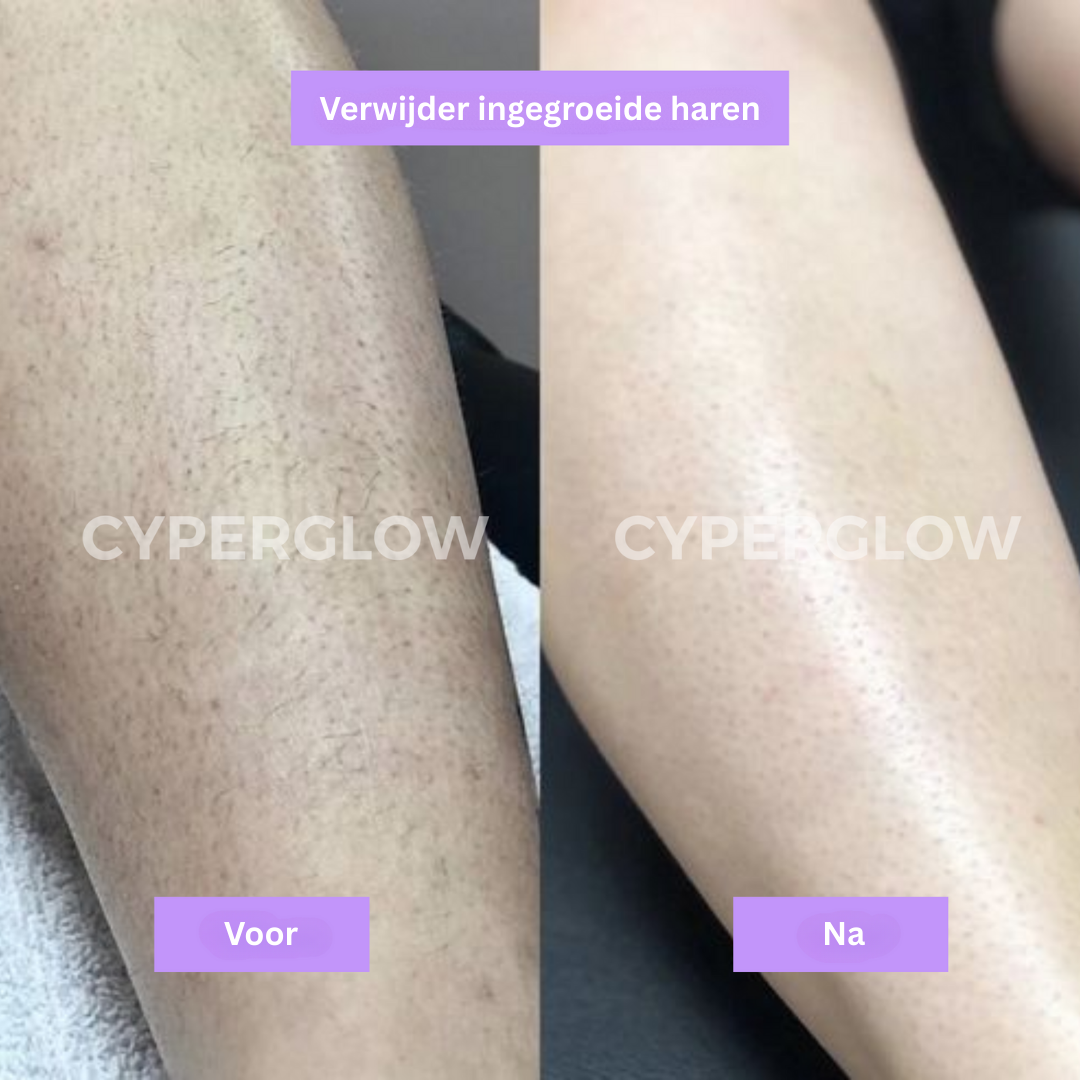 CyperGlow™ - Natuurlijk Haarverminderend Serum