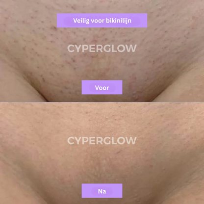 CyperGlow™ - Natuurlijk Haarverminderend Serum